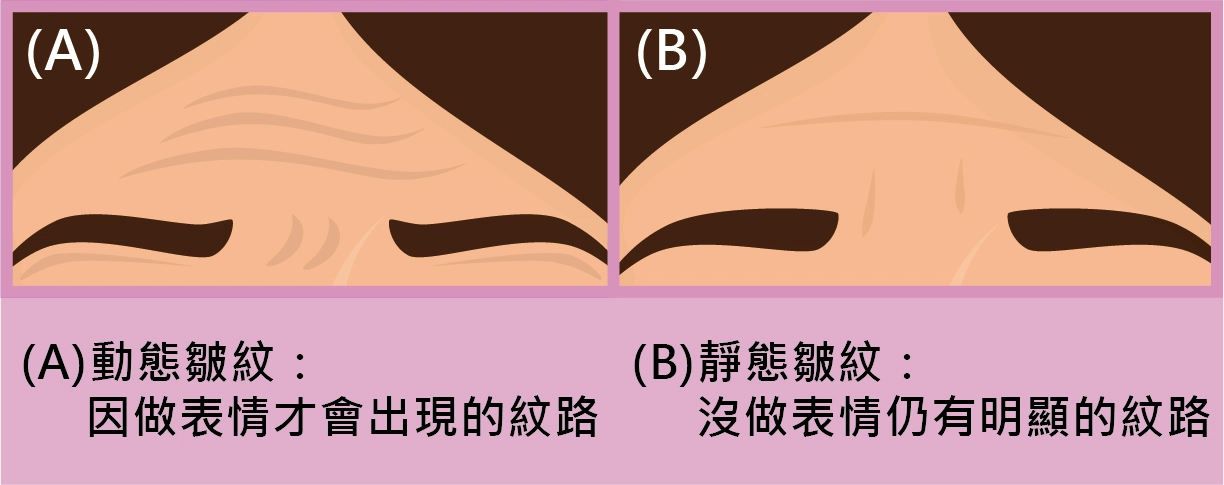 淡化皺紋化粧品真的有用嗎？有請醫師來解答！